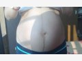 生男孩的妊娠线图片，看宝宝是男是女